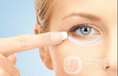 自體脂肪填充淚溝維持時間是多久？價格是多少？