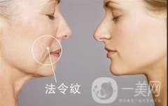 北京*去法令紋多少錢？