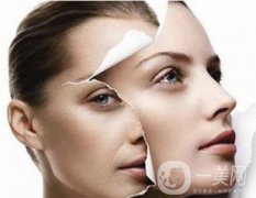 電波拉皮注意事項(xiàng)有哪些？