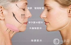 *的果到底如何呢?需要多少錢呢？