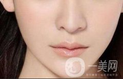 玻尿酸墊下巴會毀容嗎？注意事項有哪些？