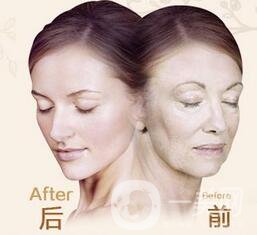 北京熱瑪吉價(jià)格