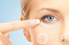 自體脂肪填充淚溝后遺癥有哪些？