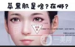 廣東注射玻尿酸豐蘋果肌多少錢?