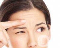 北京自體脂肪去抬頭紋價格一般是多少？