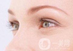 廣東玻尿酸去除魚尾紋多少錢？