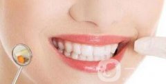 牙齒冷光美白果怎么樣？好不好？