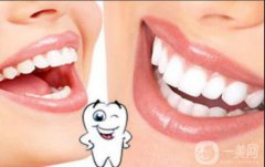 洗牙怎么樣 洗牙的利與弊有哪些
