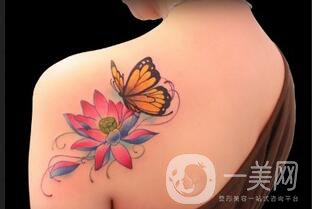 激光洗紋身