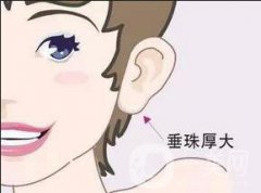 北京注射豐耳垂手術的價格一般是多少