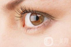 廣東玻尿酸去魚尾紋一般多少錢