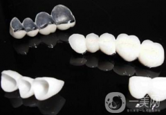 全瓷牙和烤瓷牙的區(qū)別