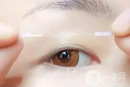 還在離不開雙眼皮貼嗎？雙眼皮手術助你雙眸