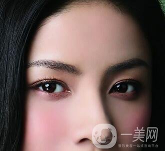 還在離不開雙眼皮貼嗎？雙眼皮手術助你雙眸