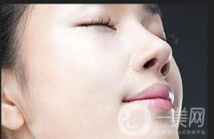 激光去胎記會(huì)反彈嗎 激光去胎記注意事項(xiàng)