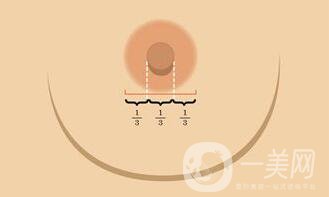 深圳乳頭縮小費(fèi)用
