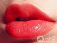 玻尿酸豐唇珠果怎么樣？