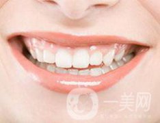 合金烤瓷牙能用幾年呢?