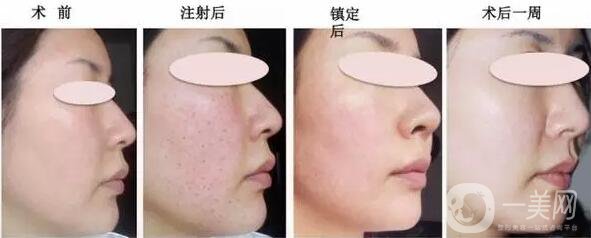 北京*價(jià)格