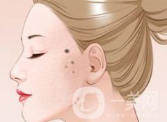 激光祛痣術(shù)后應(yīng)該怎樣護(hù)理？