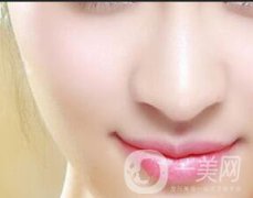 微針祛痘坑會(huì)反彈嗎