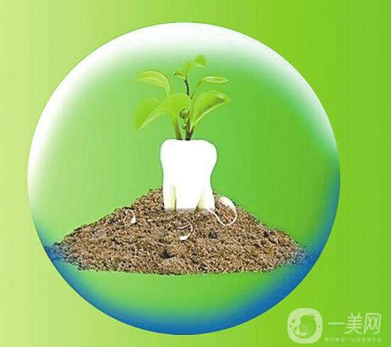 種植牙過程