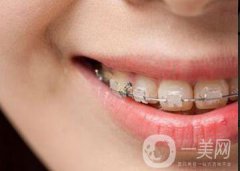 種植牙能用多久？種植牙注意事項(xiàng)有哪些？