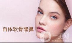 上海自軟體隆鼻多少錢