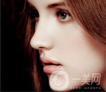 上海駝峰鼻矯正價錢大概是多少