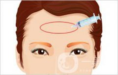 深圳自體脂肪豐額頭手術(shù)大概多少錢