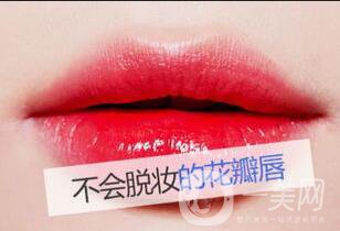 半*紋唇