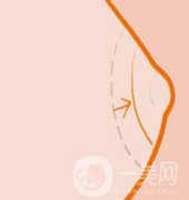 乳暈縮小整形手術(shù)價(jià)格是多少呢?