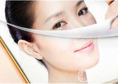 白瓷娃娃過(guò)敏怎么辦