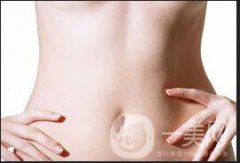 去妊娠紋價格如何 ？貴不貴？