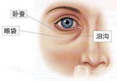 *去眼袋貴嗎 價格是多少