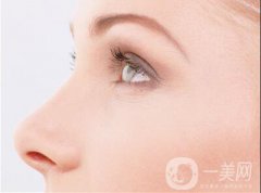 鼻翼縮小手術(shù)一般價格都是多少呢?