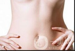 去妊娠紋價(jià)格多少錢