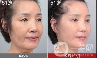 熱瑪吉*果