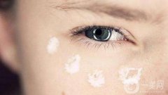 國內(nèi)現(xiàn)在去眼袋貴嗎？價格大概是多少呢？