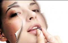 激光祛斑價格大概是多少呢