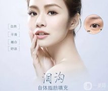 自體脂肪填充淚溝貴嗎？