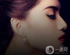 隆鼻都有哪幾種？