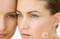 祛斑的價位大概在多少范圍內(nèi)呢?