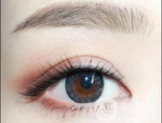 雙眼皮貴不貴呢?價(jià)格是多少？