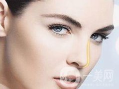 假體隆鼻大概需要多少錢？