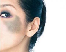 深圳去青色胎記多少錢(qián)？