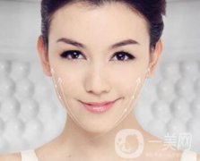 駝峰鼻矯正多久能恢復呢?