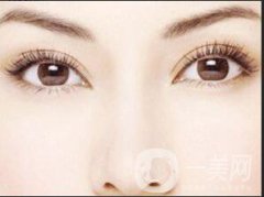 割雙眼皮去哪里比較好呢?