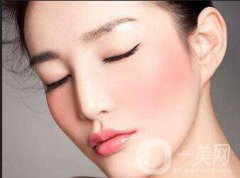 鷹鉤鼻矯正過程詳細解析