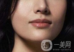 鷹鉤鼻矯正有哪些注意事項呢?